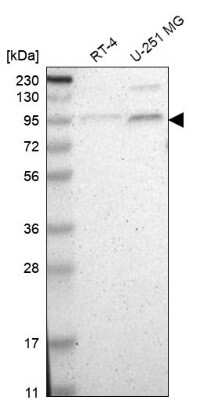 Western Blot: TAF5 Antibody [NBP1-86970]