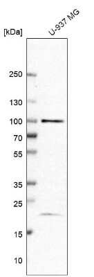 Western Blot: TAF5 Antibody [NBP1-86971]