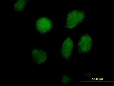 Immunocytochemistry/ Immunofluorescence: TAF5L Antibody [H00027097-B01P]