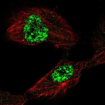 Immunocytochemistry/ Immunofluorescence: TAF5L Antibody [NBP2-57546]