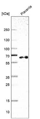 Western Blot: TAF5L Antibody [NBP2-57546]