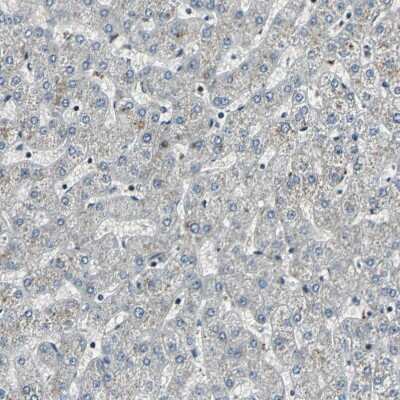 Immunohistochemistry: TAF6 Antibody [NBP1-82774]