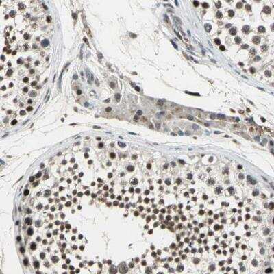 Immunohistochemistry-Paraffin: TAF6 Antibody [NBP1-82774]