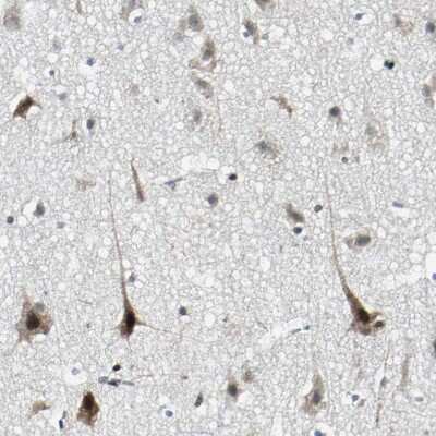 Immunohistochemistry-Paraffin: TAF6 Antibody [NBP1-82774]