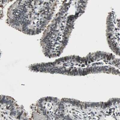 Immunohistochemistry-Paraffin: TAF6 Antibody [NBP1-82774]