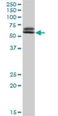 Western Blot: TAF6 Antibody [H00006878-D01P]