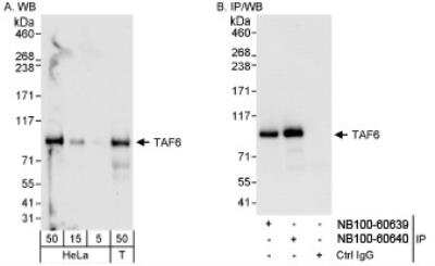 Western Blot: TAF6 Antibody [NB100-60640]