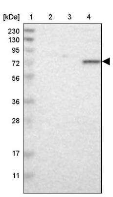 Western Blot: TAF6 Antibody [NBP1-82774]