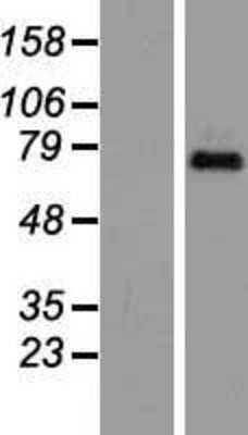 Western Blot: TAF6 Overexpression Lysate [NBP2-07723]