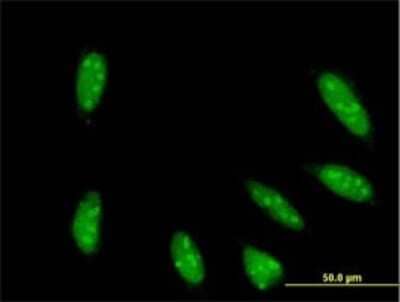 Immunocytochemistry/ Immunofluorescence: TAF6L Antibody (1C5) [H00010629-M01]