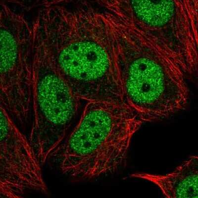 Immunocytochemistry/ Immunofluorescence: TAF6L Antibody [NBP2-39083]