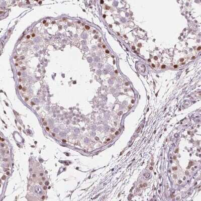 Immunohistochemistry-Paraffin: TAF6L Antibody [NBP2-39083]