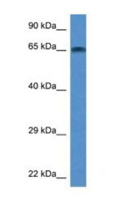 Western Blot: TAF6L Antibody [NBP1-74133]