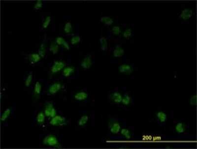 Immunocytochemistry/ Immunofluorescence: TAF7 Antibody (2C5) [H00006879-M01]