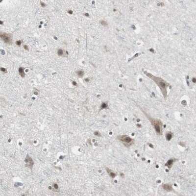 Immunohistochemistry-Paraffin: TAF7 Antibody [NBP1-80704]