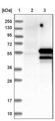 Western Blot: TAF7 Antibody [NBP1-80704]