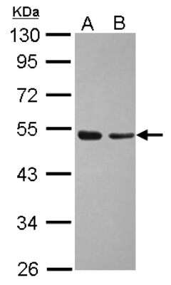 Western Blot: TAF7 Antibody [NBP2-20556]