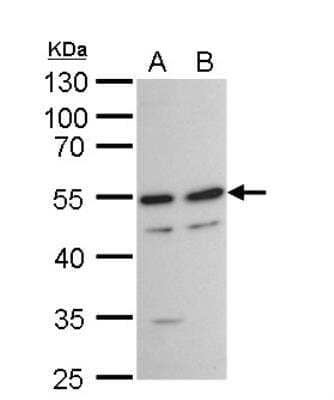 Western Blot: TAF7 Antibody [NBP2-20556]