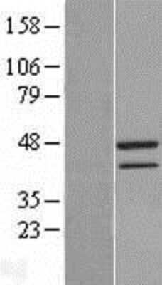 Western Blot: TAF7 Overexpression Lysate [NBL1-16688]