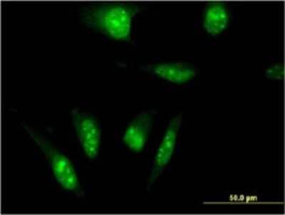 Immunocytochemistry/ Immunofluorescence: TAF7L Antibody (3E10) [H00054457-M04]