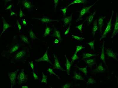 Immunocytochemistry/ Immunofluorescence: TAF7L Antibody [NBP3-06642]