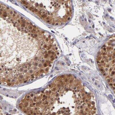 Immunohistochemistry-Paraffin: TAF7L Antibody [NBP1-84350]