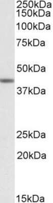 Western Blot: TAF7L Antibody [NBP1-45232]