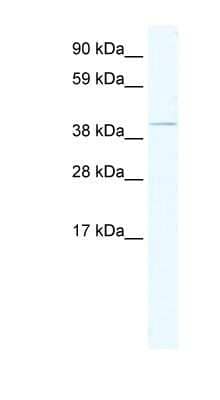 Western Blot: TAF7L Antibody [NBP1-80292]