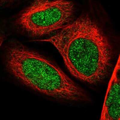 Immunocytochemistry/ Immunofluorescence: TAF8 Antibody [NBP1-81986]