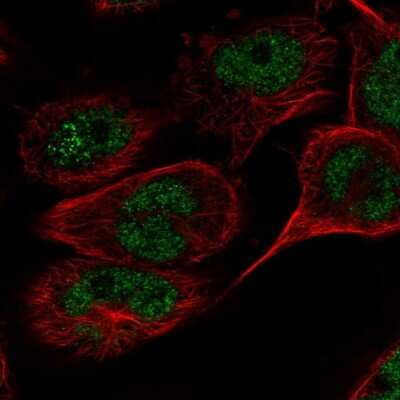 Immunocytochemistry/ Immunofluorescence: TAF8 Antibody [NBP2-38189]