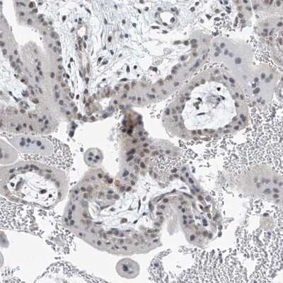 Immunohistochemistry: TAF8 Antibody [NBP2-38189]