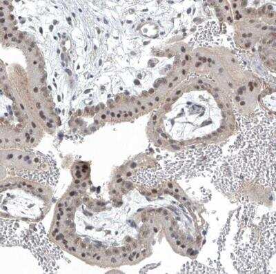 Immunohistochemistry-Paraffin: TAF8 Antibody [NBP1-81986]