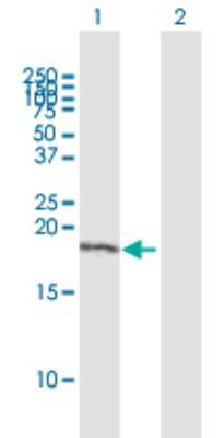 Western Blot: TAF8 Antibody [H00129685-B01P]