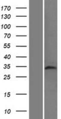 Western Blot: TAF8 Overexpression Lysate [NBP2-05644]