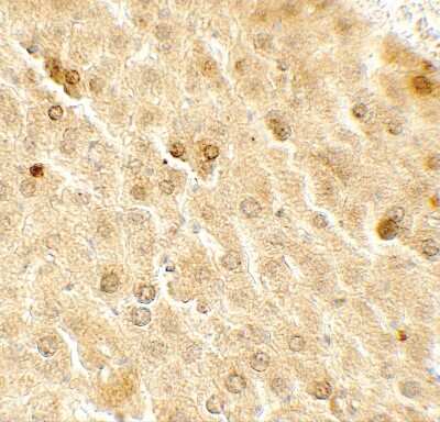 Immunohistochemistry: TAF9 Antibody - BSA Free [NBP2-41266]