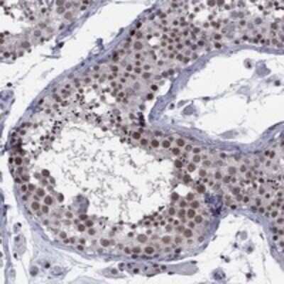 Immunohistochemistry-Paraffin: TAF9 Antibody [NBP3-17443]