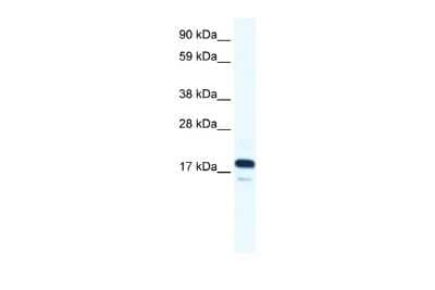 Western Blot: TAF9 Antibody [NBP2-84289]