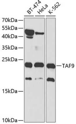 Western Blot: TAF9 AntibodyBSA Free [NBP2-93735]