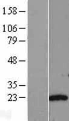 Western Blot: Adenylate Kinase 6 Overexpression Lysate [NBL1-16689]