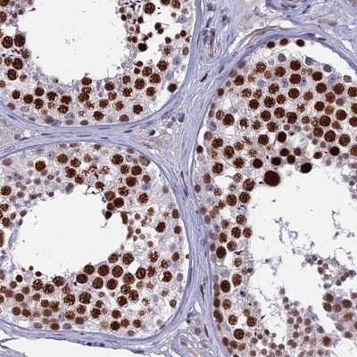 Immunohistochemistry-Paraffin: TAF9b Antibody [NBP1-92475]