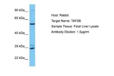 Western Blot: TAF9b Antibody [NBP2-88404]