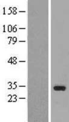 Western Blot: TAF9b Overexpression Lysate [NBL1-16690]