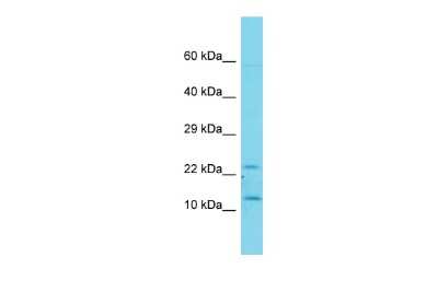 Western Blot: TAFA1/FAM19A1 Antibody [NBP2-88405]