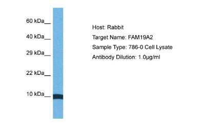 Western Blot: TAFA2/FAM19A2 Antibody [NBP2-86843]