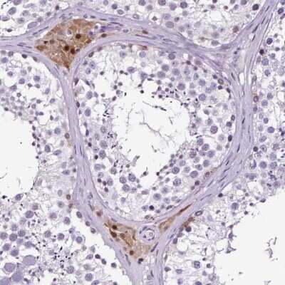Immunohistochemistry-Paraffin: TAFA3/FAM19A3 Antibody [NBP2-30489]