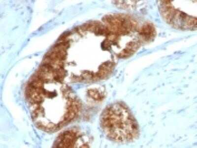 Immunohistochemistry-Paraffin: TAG-72 Antibody (B72.3 + CA72/733) - IHC-Prediluted [NBP2-45178]