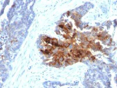 Immunohistochemistry-Paraffin: TAG-72 Antibody (B72.3 + CA72/733) [NBP2-34241]