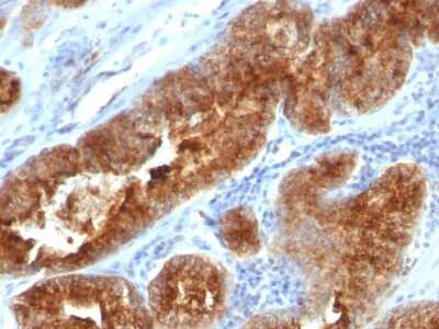 Immunohistochemistry-Paraffin: TAG-72 Antibody (B72.3 + CC49) - Azide and BSA Free [NBP2-34558]
