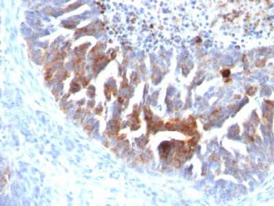 Immunohistochemistry-Paraffin: TAG-72 Antibody (B72.3 + CC49) - Azide and BSA Free [NBP2-34558]