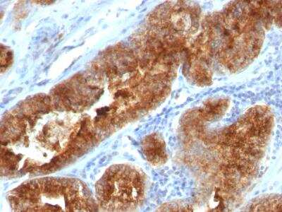 Immunohistochemistry-Paraffin: TAG-72 Antibody (B72.3 + CC49) [NBP2-34242]